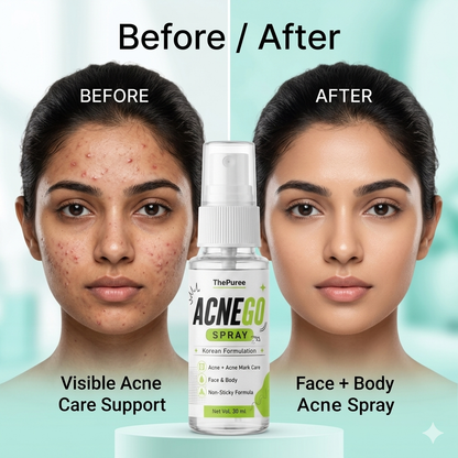 ACNEGO Spray – Face & Body Acne Care Spray