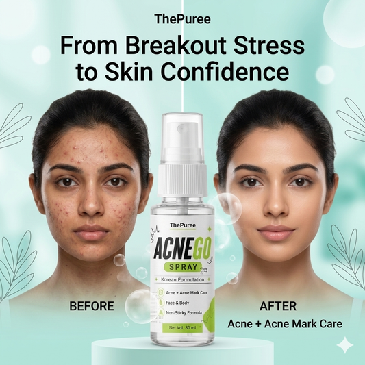 ACNEGO Spray – Face & Body Acne Care Spray