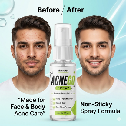 ACNEGO Spray – Face & Body Acne Care Spray