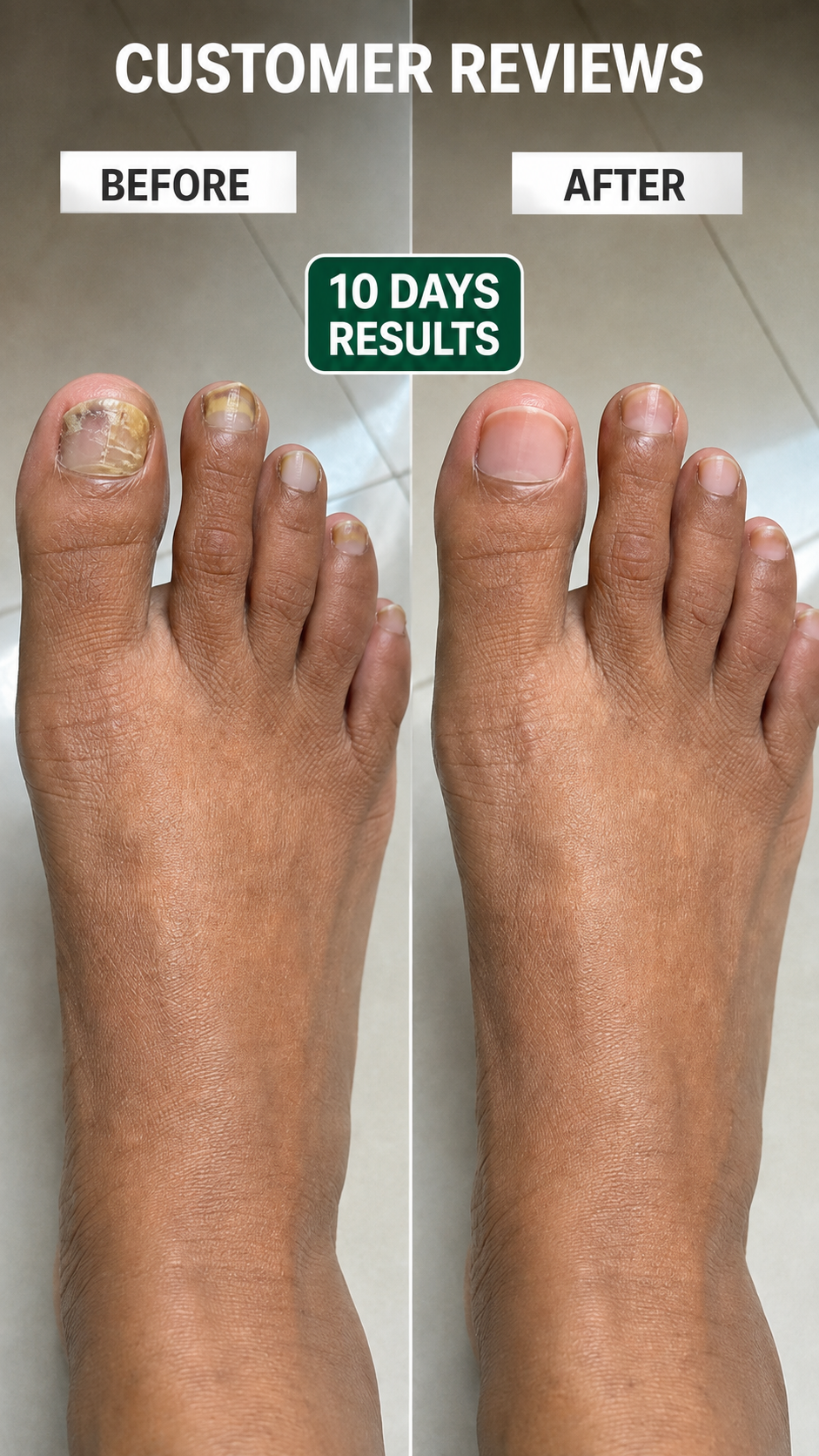 Anti Paronychia Relief Nail Oil - Buy 1 Get 1 FREE🔥