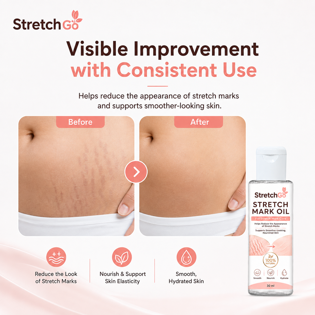 Stretchgo  Stretchmark Removal Herbal Oil