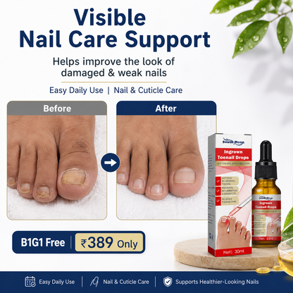 Toenail Nail Repair Oil for Damaged & Weak Nails – Buy 1 Get 1 FREE 🔥