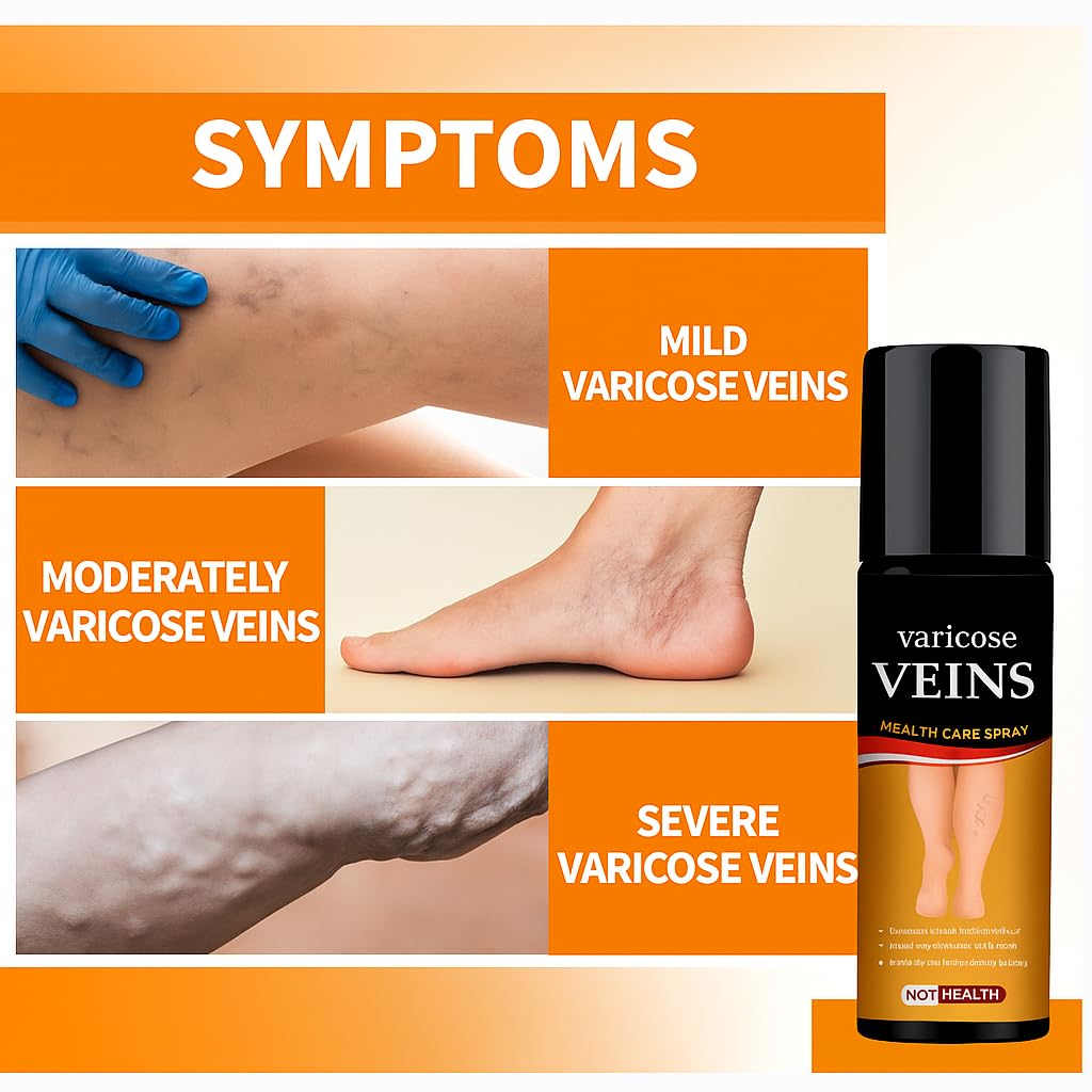 Turmeric Varicose Veins Relief Herbal Spray🌿