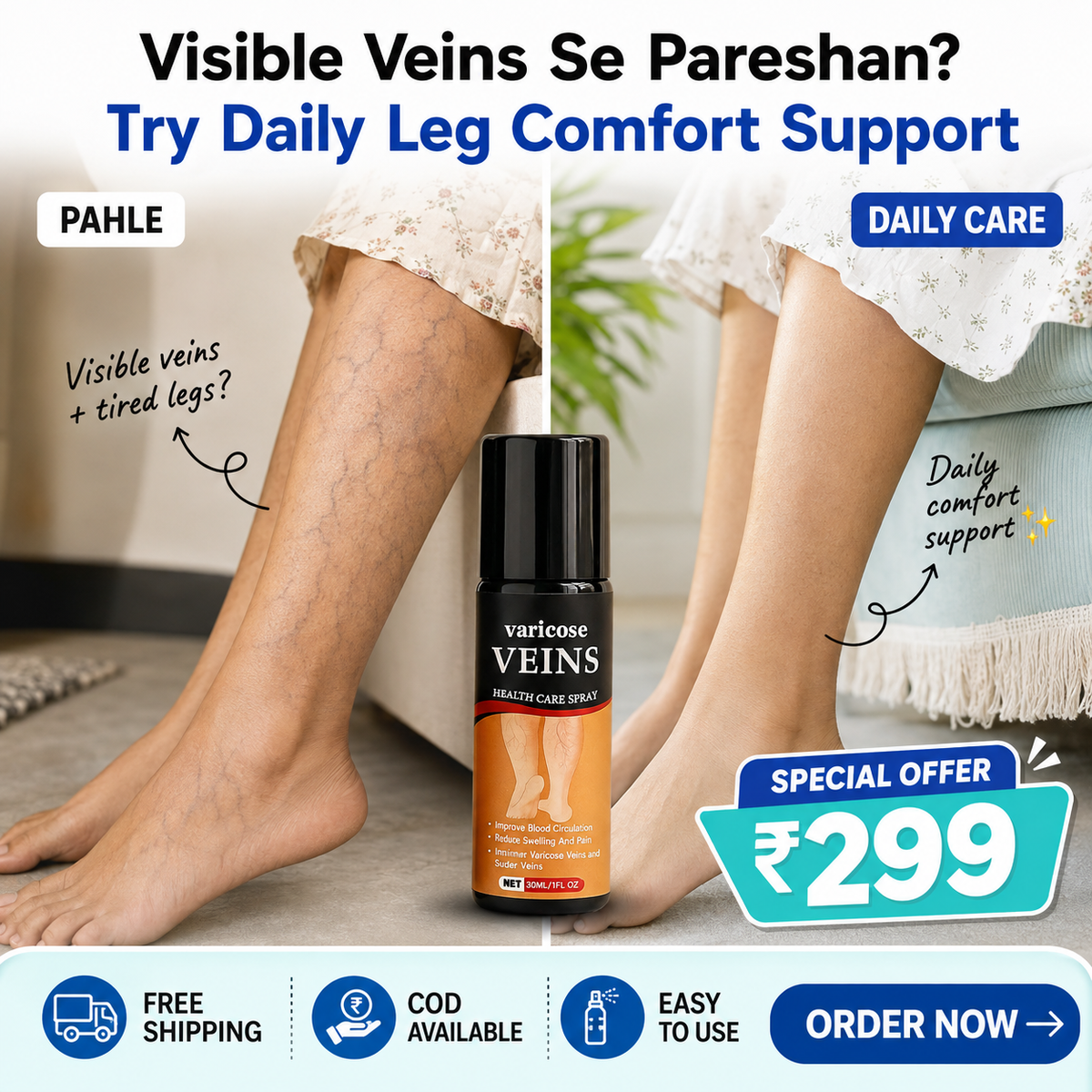 Turmeric Varicose Veins Relief Herbal Spray🌿