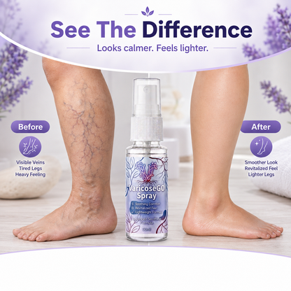 VaricoseGO Relief Herbal Varicose Relief Spray