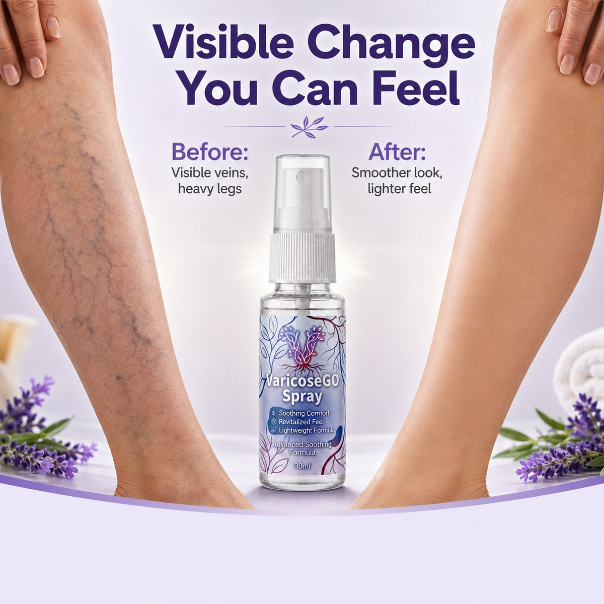 VaricoseGO Relief Herbal Varicose Relief Spray