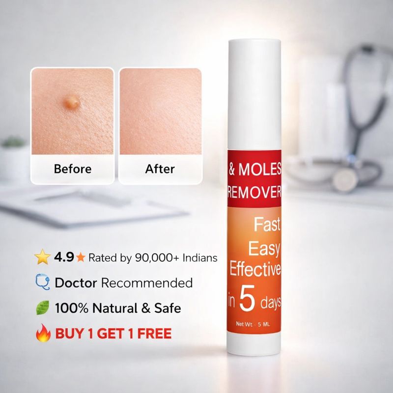 Warts & Tags Remover Roll On - (Buy 1 Get 1 Free🔥🔥)