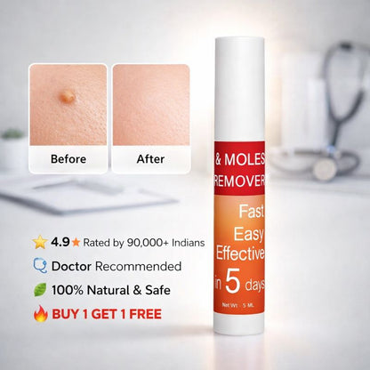 Warts & Tags Remover Roll On - (Buy 1 Get 1 Free🔥🔥)