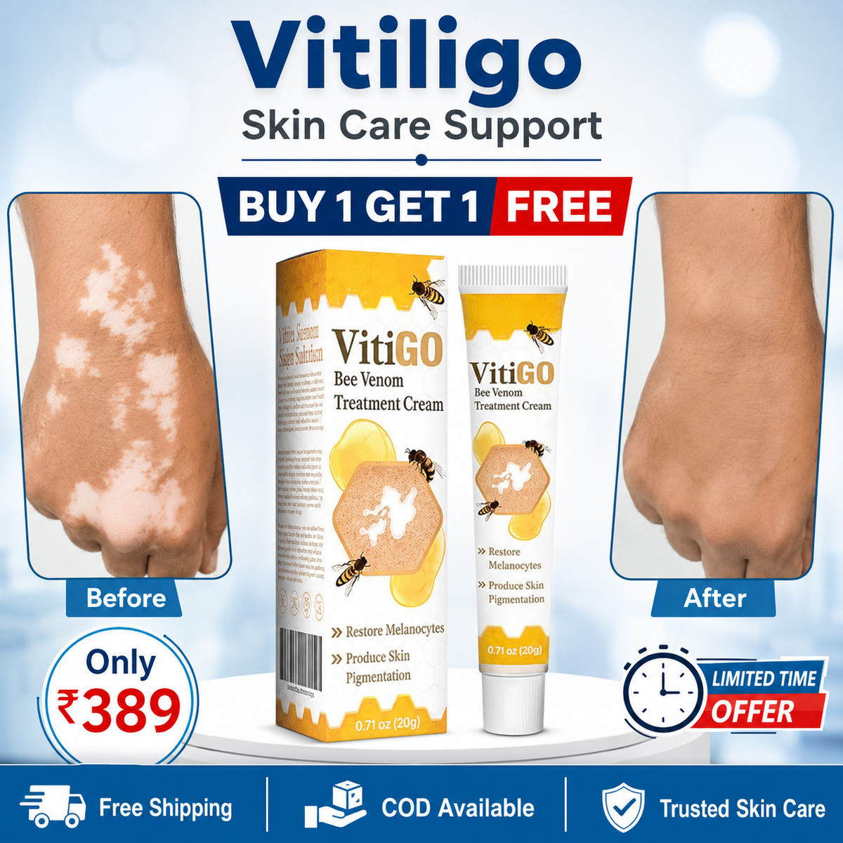VitiGO Corrector Cream - BUY 1 GET 1 FREE 🔥