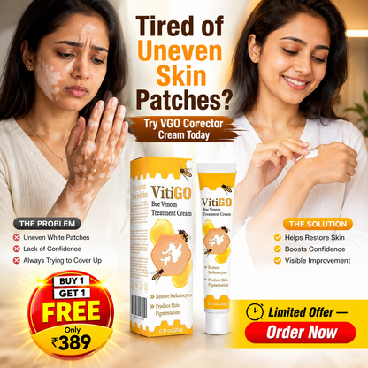 VitiGO Corrector Cream - BUY 1 GET 1 FREE 🔥