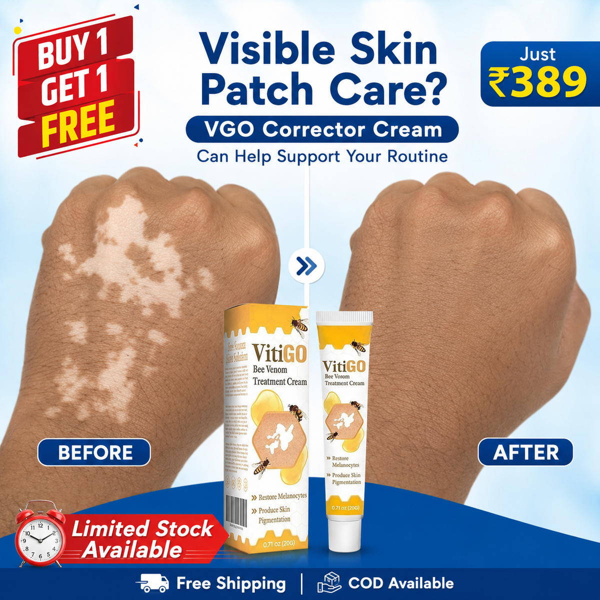 VitiGO Corrector Cream - BUY 1 GET 1 FREE 🔥