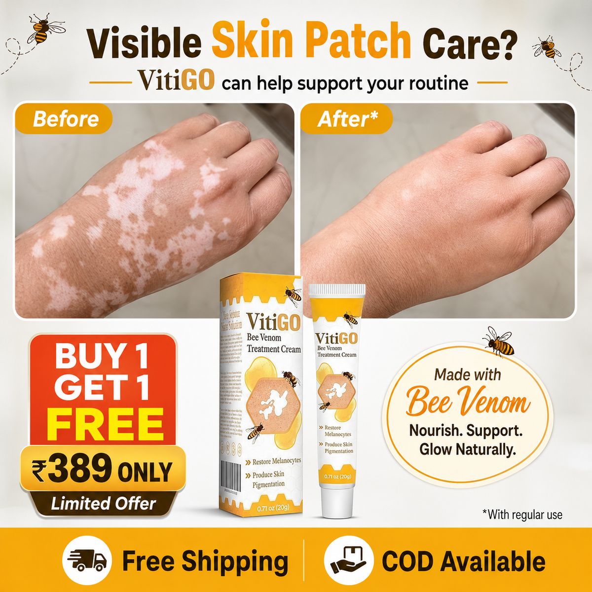 VitiGO Corrector Cream - BUY 1 GET 1 FREE 🔥