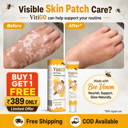 VitiGO Corrector Cream - BUY 1 GET 1 FREE 🔥