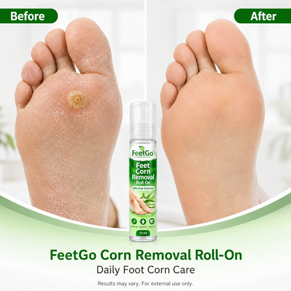 FeetGo Corn Removal Roll-On