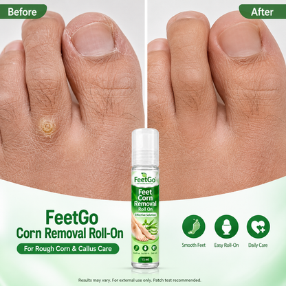 FeetGo Corn Removal Roll-On
