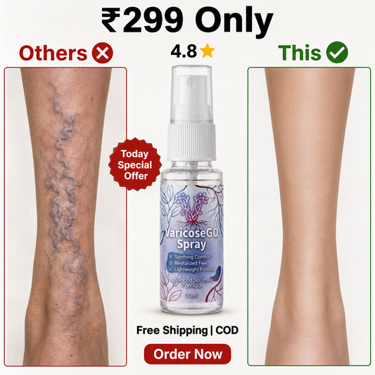 VaricoseGO Relief Herbal Varicose Relief Spray
