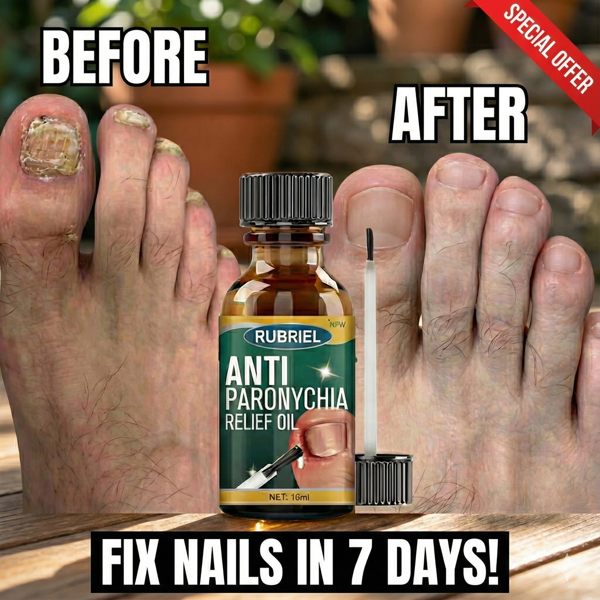 Anti Paronychia Relief Nail Oil - Buy 1 Get 1 FREE🔥