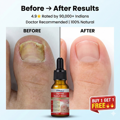 Toenail Nail Repair Oil - BUY 1 GET 1 FREE🔥🔥