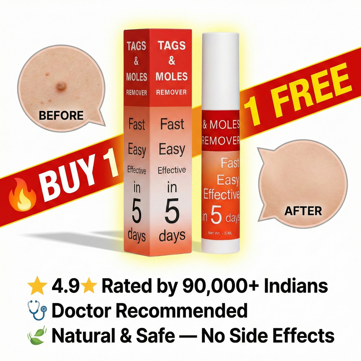 Warts & Tags Remover Roll On - (Buy 1 Get 1 Free🔥🔥)