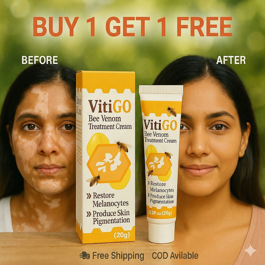 VitiGO Corrector Cream - BUY 1 GET 1 FREE 🔥