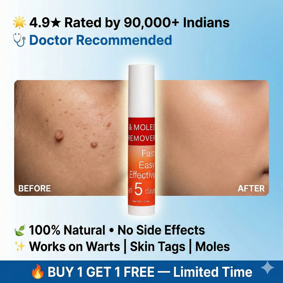 Warts & Tags Remover Roll On - (Buy 1 Get 1 Free🔥🔥)
