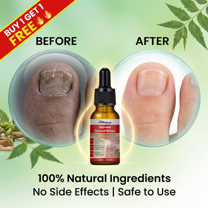 Toenail Nail Repair Oil - BUY 1 GET 1 FREE🔥🔥