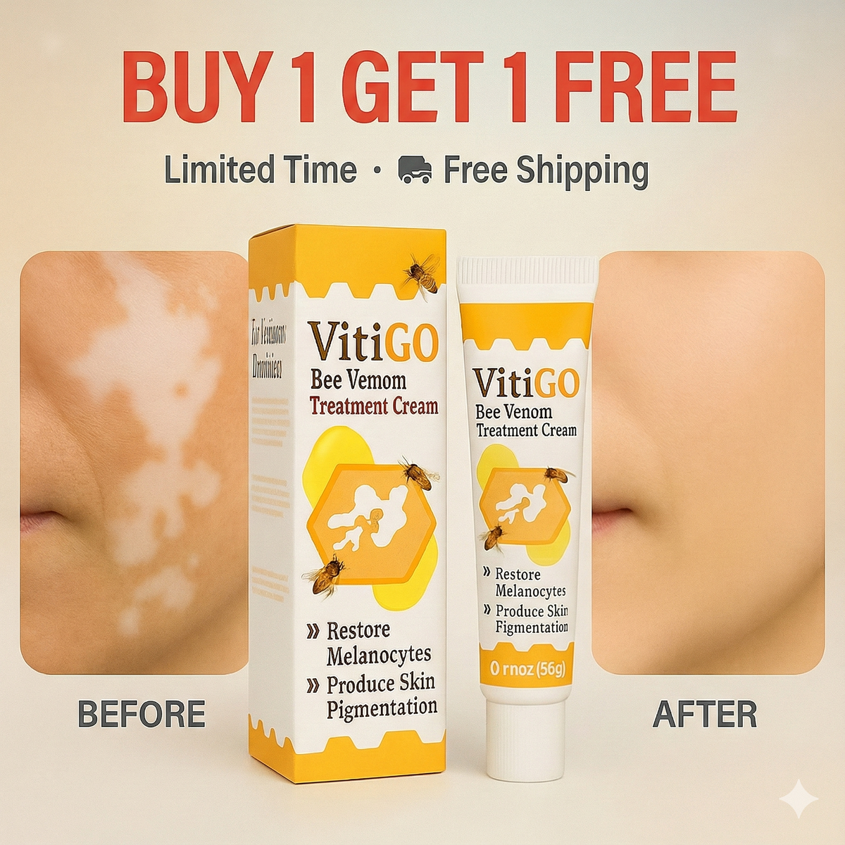 VitiGO Corrector Cream - BUY 1 GET 1 FREE 🔥