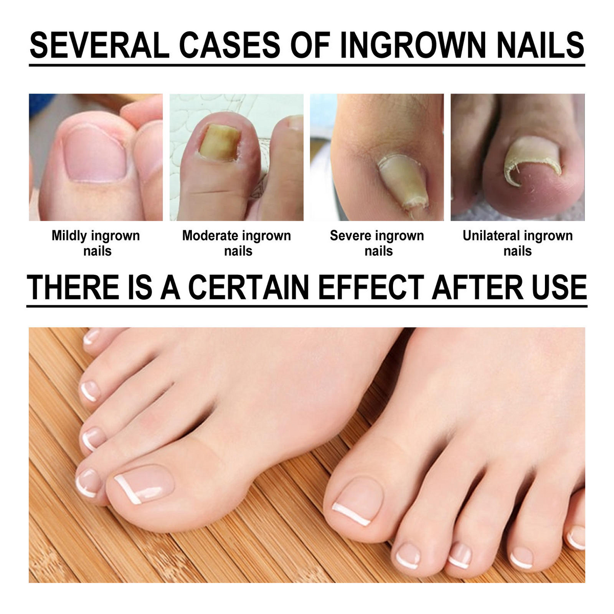 Toenail Nail Repair Oil - BUY 1 GET 1 FREE🔥🔥
