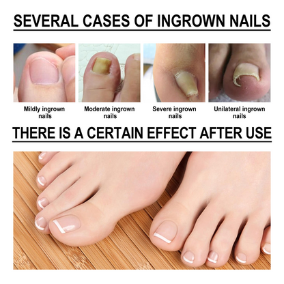 Toenail Nail Repair Oil - BUY 1 GET 1 FREE🔥🔥