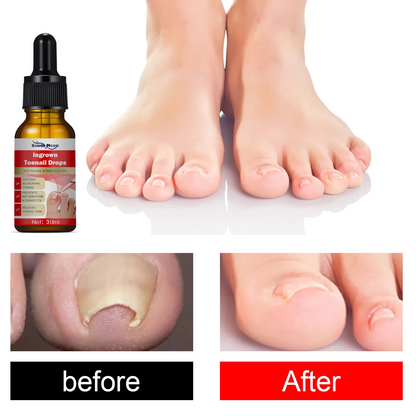 Toenail Nail Repair Oil - BUY 1 GET 1 FREE🔥🔥