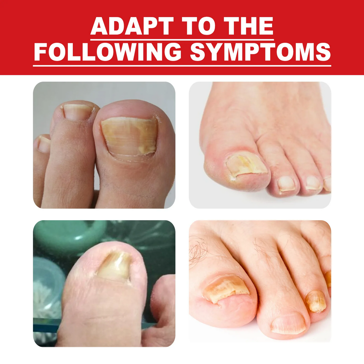 Toenail Nail Repair Oil - BUY 1 GET 1 FREE🔥🔥