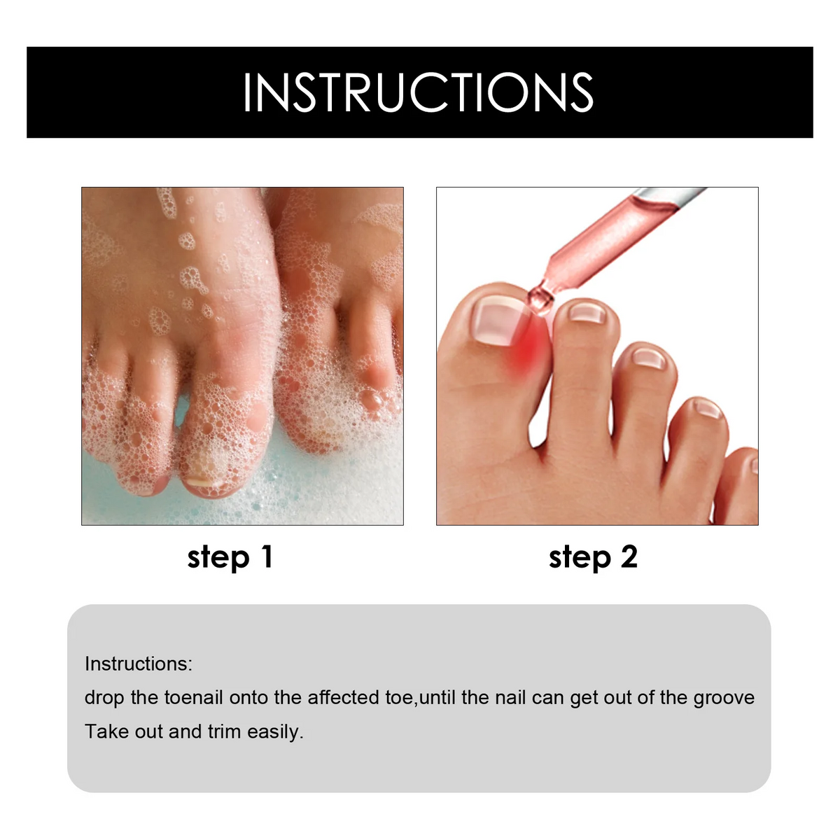 Toenail Nail Repair Oil - BUY 1 GET 1 FREE🔥🔥