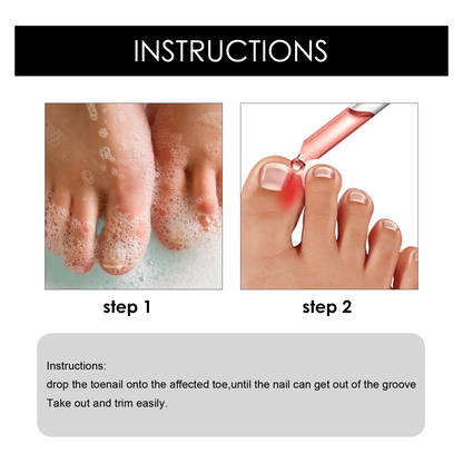 Toenail Nail Repair Oil - BUY 1 GET 1 FREE🔥🔥