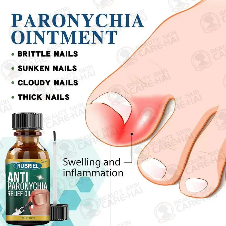 Anti Paronychia Relief Nail Oil - Buy 1 Get 1 FREE🔥