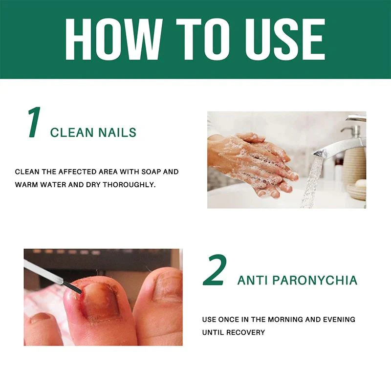 Anti Paronychia Relief Nail Oil - Buy 1 Get 1 FREE🔥