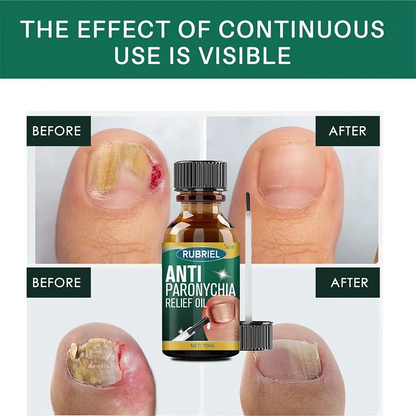 Anti Paronychia Relief Nail Oil - Buy 1 Get 1 FREE🔥