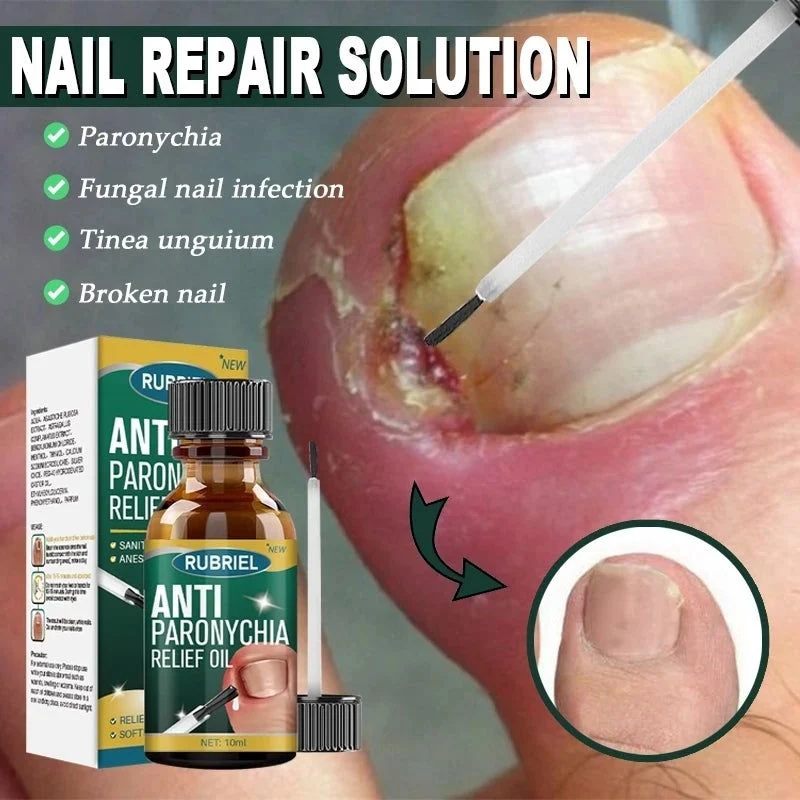Anti Paronychia Relief Nail Oil - Buy 1 Get 1 FREE🔥
