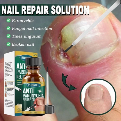 Anti Paronychia Relief Nail Oil - Buy 1 Get 1 FREE🔥