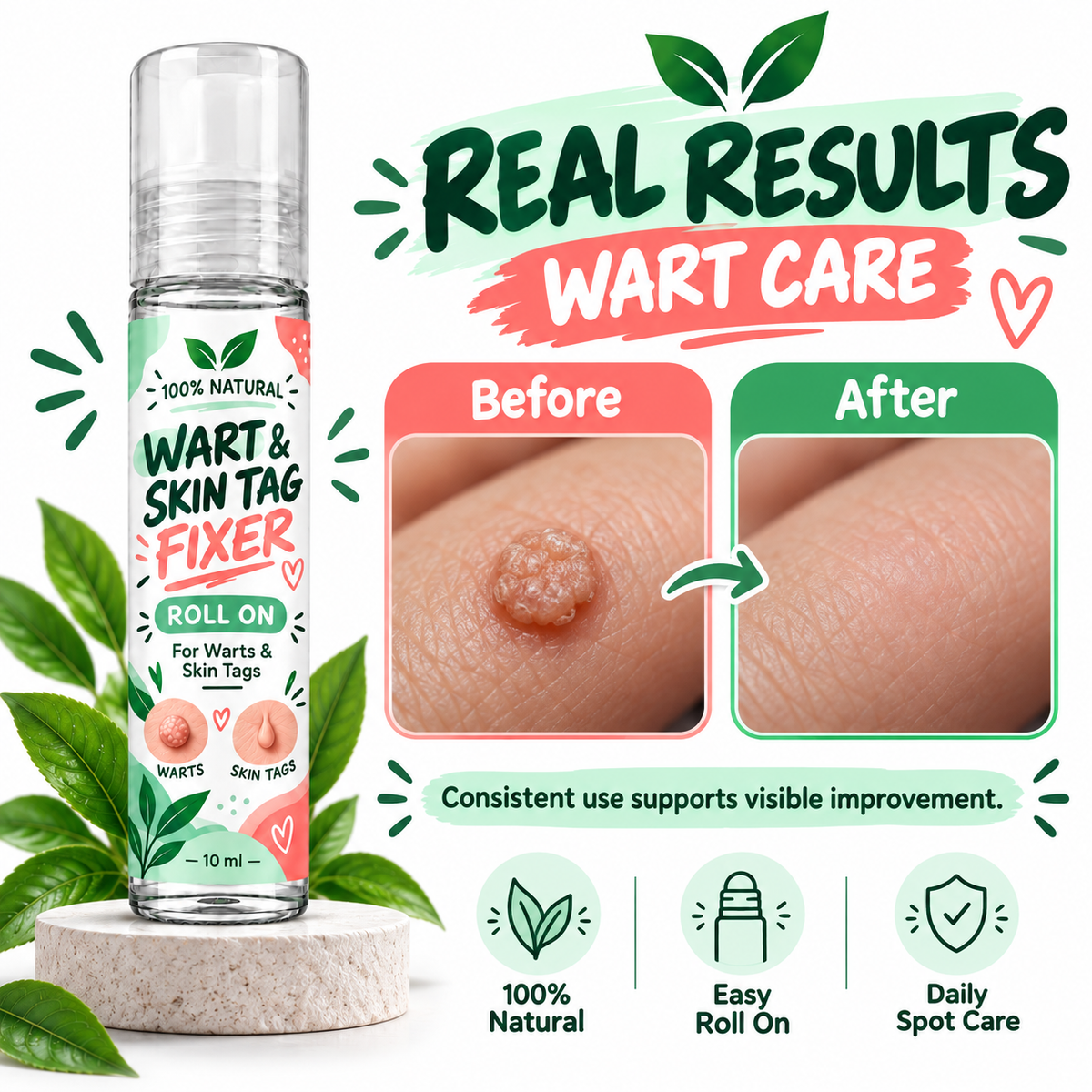 Warts & Skin Tags Fixer Roll On