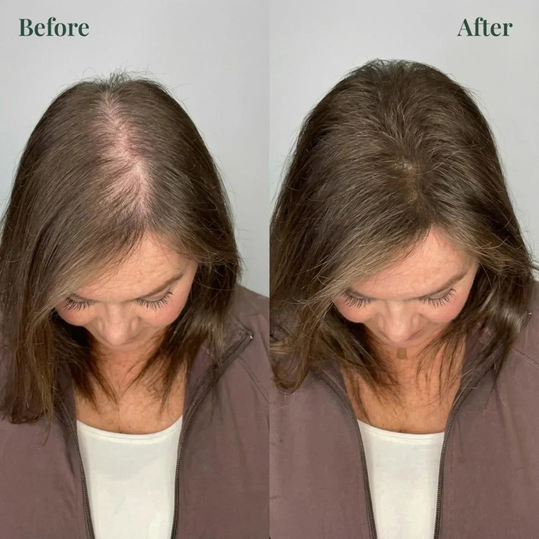 Japanese Kerarose Rosemary Shampoo (Buy 1 Get 1 Free 🔥🔥)
