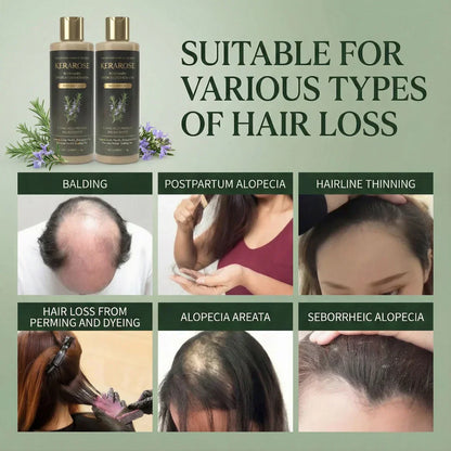 Japanese Kerarose Rosemary Shampoo (Buy 1 Get 1 Free 🔥🔥)
