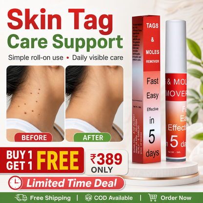 Warts & Tags Remover Roll On - (Buy 1 Get 1 Free🔥🔥)