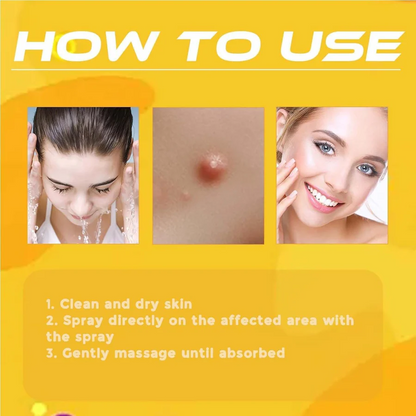 Wart & Skin Tag Remover Spray - 🔥 BUY 1 GET 1 FREE